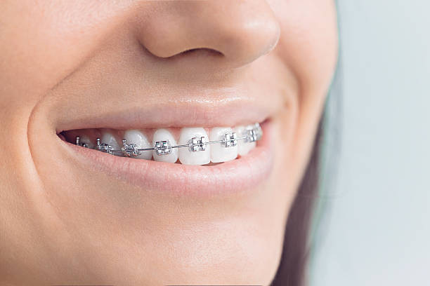 Best Dental Exams and Cleanings  in Webster Groves, MO